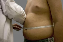 Lính Mỹ đổ xô đi hút mỡ bụng