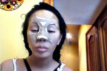 Hành trình “dao kéo” thành quái vật của ca sĩ Nga