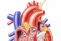 Đàn ông có tinh hoàn lớn dễ bị bệnh tim