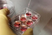 Chứng kiến quy trình đông lạnh trứng của chị em