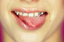 Những thói quen xấu phá hỏng hàm răng