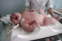 Những em bé sơ sinh khổng lồ