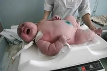 Những em bé sơ sinh khổng lồ