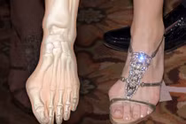 Giày cao gót quái dị làm biến dạng xương chân