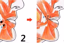 Tận mục quy trình cắt miệng xinh như "hot girl" Hàn