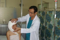 Sơn nữ mặt khổng lồ đã được phẫu thuật