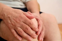 Đồ uống có đường tăng nguy cơ bệnh gút