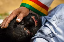 Hãi hùng chứng kiến cảnh chữa bệnh bằng nghi lễ trừ tà