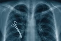 Những sơ suất y tế không thể chấp nhận được