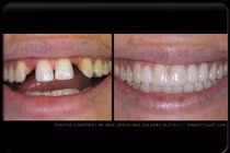 Những dịch vụ nha khoa thẩm mỹ hot nhất