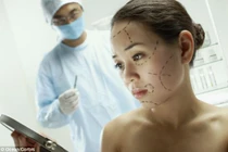 Nỗi ám ảnh của những tín đồ thẩm mỹ