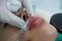 Hành trình 30 lần “dao kéo” của nữ MC Trung Quốc