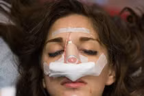 Zoom cận cảnh độn cằm, sửa mũi rùng rợn của gái trẻ