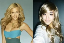 Những ca phẫu thuật điên rồ bắt chước người khác