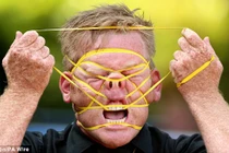 Những khuôn mặt biến dạng xấu xí vì dây cao su