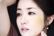 Những phương pháp làm đẹp không phẫu thuật 