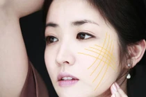 Những phương pháp làm đẹp không phẫu thuật 