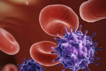 Brazil thử nghiệm vaccine HIV trên khỉ