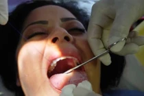 Những cách giảm cân điên rồ nhất thế giới