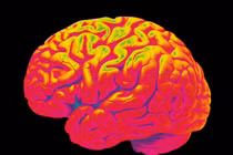 Đau nửa đầu có thể gây tổn thương não vĩnh viễn