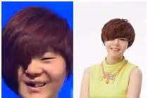 “Vịt bầu” hóa “thiên nga” nhờ 40 lần phẫu thuật thẩm mỹ