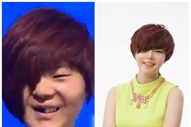 “Vịt bầu” hóa “thiên nga” nhờ 40 lần phẫu thuật thẩm mỹ