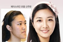 Khuôn mặt biến đổi “lạ” sau làm đẹp