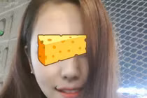 Phát cuồng kiểu phẫu thuật miệng hình cánh cung