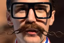 Điểm mặt những ca phẫu thuật thẩm mỹ lạ lùng nhất