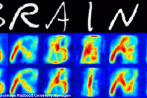 Sắp đọc được suy nghĩ bằng cách chụp não