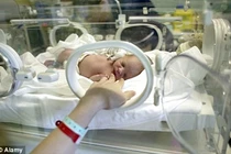 Bác sĩ phán chết, “xác chết” sống lại sau 45 phút