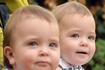 Nụ cười cực đáng yêu của cặp song sinh dính liền