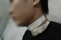 Bắc Ninh: Điều tra nghi án tài xế taxi bị cứa cổ suýt chết