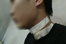 Bắc Ninh: Điều tra nghi án tài xế taxi bị cứa cổ suýt chết