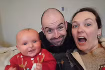 Bé gái 2 tuổi có làn da đỏ như 'tôm luộc' vì bệnh vảy nến