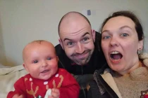 Bé gái 2 tuổi có làn da đỏ như 'tôm luộc' vì bệnh vảy nến