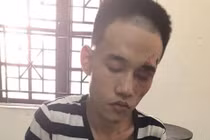 Nghi phạm cứa cổ bạn bố tử vong có biểu hiện bất thường