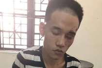 Nghi phạm cứa cổ bạn bố tử vong có biểu hiện bất thường