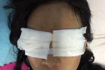 Vì đâu mẹ chồng nhẫn tâm tạt a xít con dâu? 