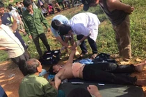 Người đàn ông tự rạch bụng vì nghĩ trong bụng có bom