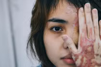 Cựu thiếu úy tạt axit vợ sắp cưới khai lý do ra tay tàn độc