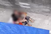 Đến thăm cháu, bà ngoại bị chó nhà nổi điên cắn nhập viện