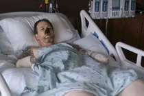 Phải cắt tứ chi vì bệnh nghi lây từ chó cưng