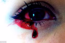 Cô gái mắc bệnh lạ chảy máu 5 lần/ngày