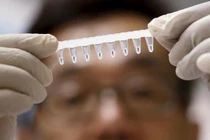 Virus Zika có liên quan đến hội chứng thần kinh Guillain-Barre