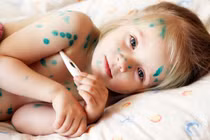 3 bệnh dễ truyền nhiễm trong mùa nồm ẩm