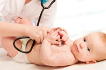 Các giai đoạn phát triển của bệnh thủy đậu