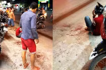 Trích xuất camera, bắt được kẻ chém đứt tay thanh niên