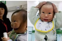 Những dị tật kỳ lạ nhất trên cơ thể người