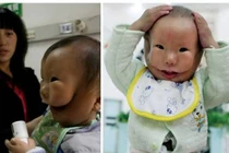 Những dị tật kỳ lạ nhất trên cơ thể người